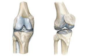 Partial Knee Replacement - Dr. Anthony Spriggins